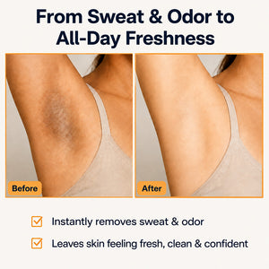 Aloe Vera + Vitamin E Fresh Odor Control On-The-Go Freshness Wipes|Citrus