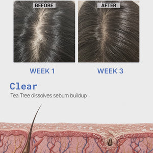 GrowMaxx Hair Growth Ampoule | PDRN, Copper Peptides & Exosomes | Scalp Treatment For Thinning Hair